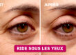 Secrets pour Prévenir et Atténuer les Rides Sous les Yeux, Gardez une Peau Jeune
