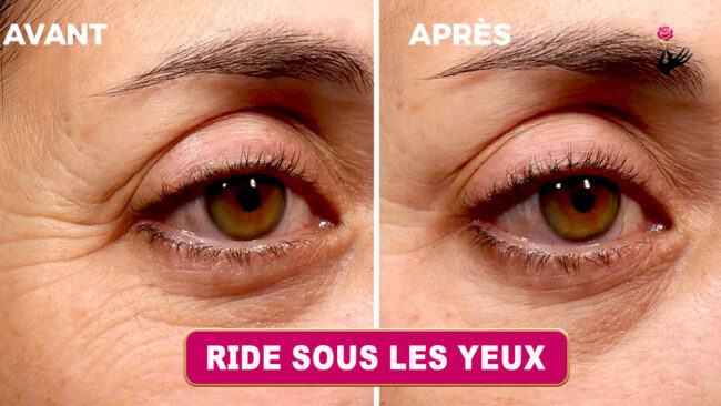 Secrets pour Prévenir et Atténuer les Rides Sous les Yeux, Gardez une Peau Jeune